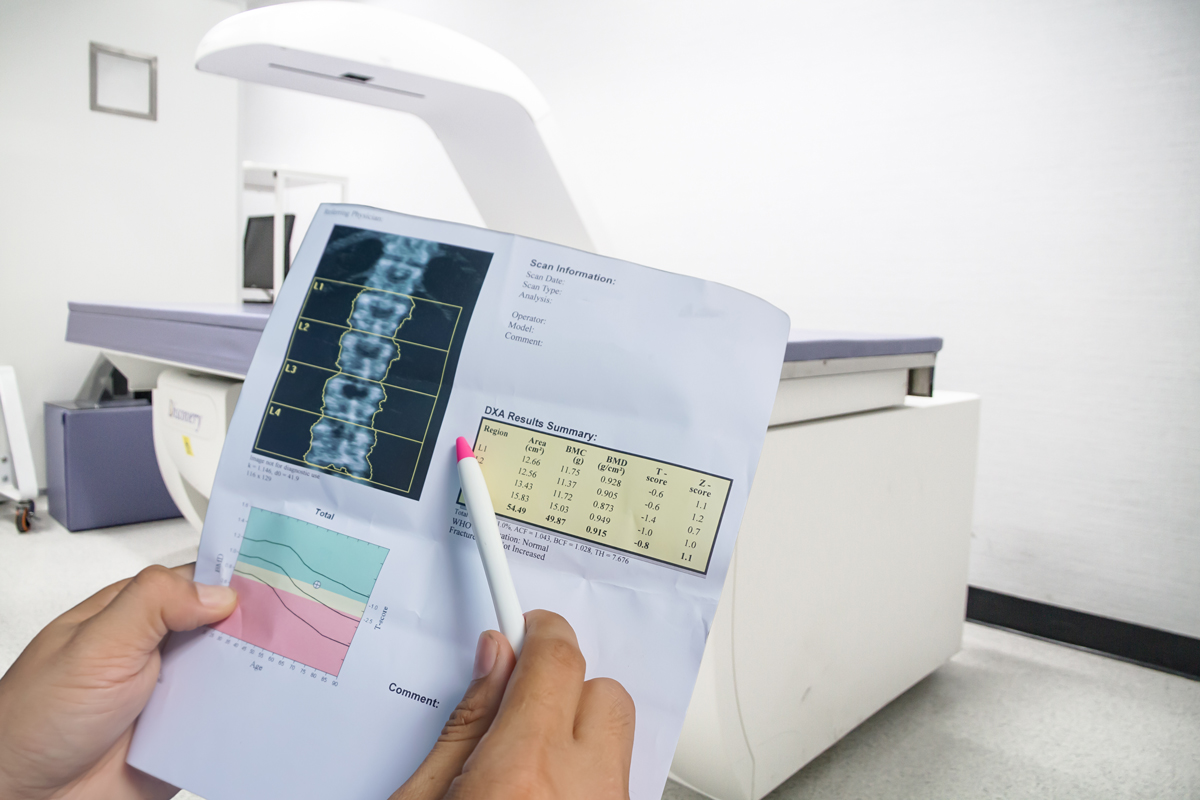 Bone Mineral Density BMD